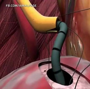 Kidney Transplant | Genius Engineering