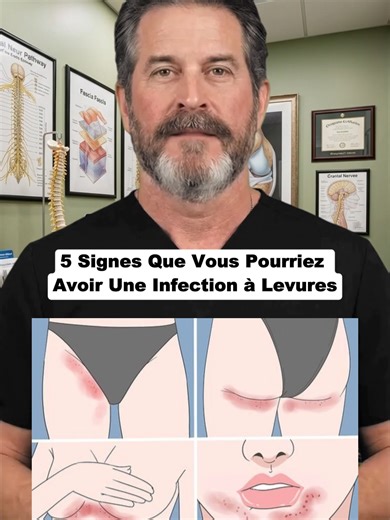 5 signes que vous pourriez avoir une infection à levures :#santé #santénaturelle #france