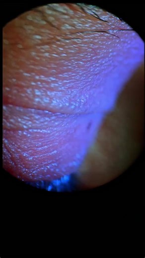 Understanding Eye Health: Ophthalmology Insights