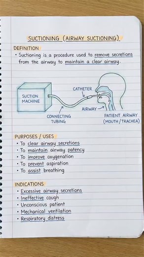 doctor_life_line🏥🩺 | SUCTIONING (AIRWAY SUCTIONING)....▪️▪️ . . . | Instagram