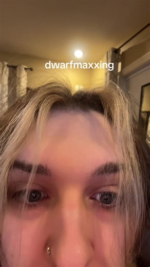 i would probably also develop a glasgow accent #dwarf #balding #baldmen #scalptattoo #tattoo