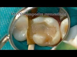 Introduction to Ribbond