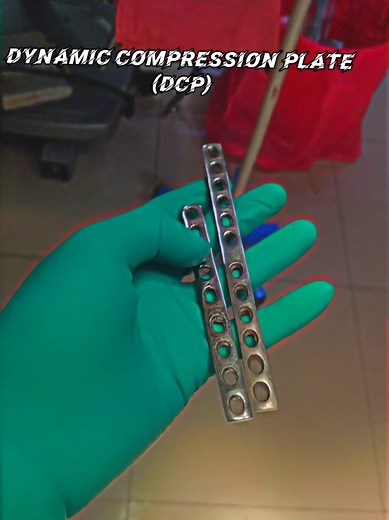 Dynamic Compression Plate (DCP): Innovative Orthopedic Solution