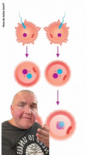 How do twins form? #twins #twinpregnancy #pregnancyjourney