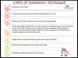 Sandwich technique restoration step by step