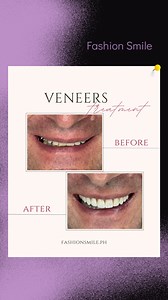 2.9K views | Smiles come in many forms, and each one should perfectly...