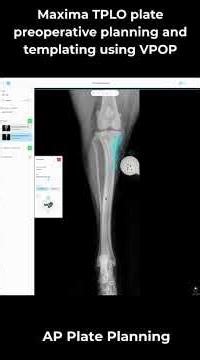 Maxima TPLO Plate Preoperative Planning and Templating Using VPOP