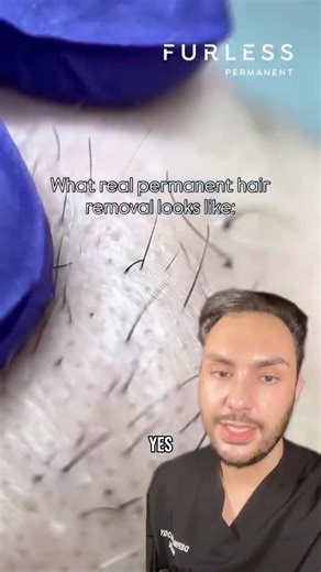 The ONLY permanent hair removal treatment!