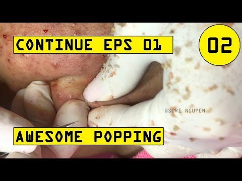 Suri Job 02: AWESOME POPPING | Part 2