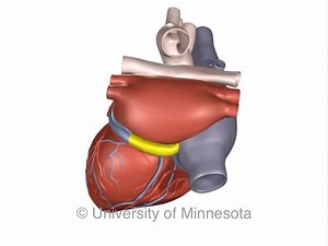 19K views · 55 reactions | 變Coronary Sinus  At a length varying...