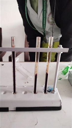 westergren tube and wintrobe tube practical💉🏥#viralvideo#shorts#ytshort#bams#medico#practical