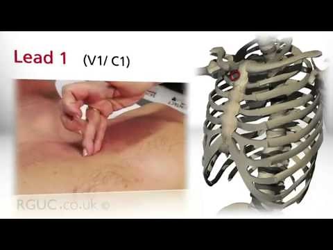 Medical assistant certification exam review ekg ecg interpretation and setup