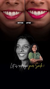 6K views · 251 reactions | Smile makeover achieve your dream smile...