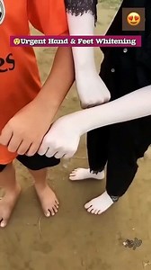 Easy Hand Whitening Tips & Tricks | Remove Hand Dirt & Darkness, Get Fair Hand #handwhitening #suntan #skinbrightening #manicure #viralreelsfb #reelsfypシ | Health Beauty Treat