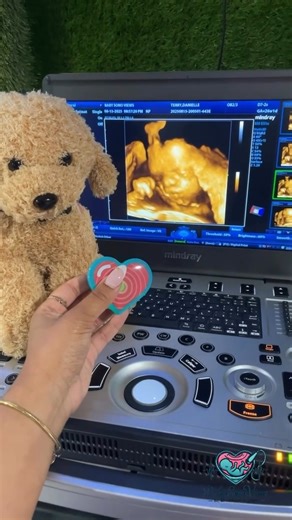 If there’s one thing we know for sure, it’s that this is the best sound in the whole world! 🥹 With My Baby’s Heartbeat Bear, you can record and preserve up to 20-seconds of a fetal heartbeat for your ultrasound clients. 💓🧸 Visit our website to learn more: https://bit.ly/4kXaLAz 🎥: Baby Sono Views in Queens, New York | My Baby's Heartbeat Bear