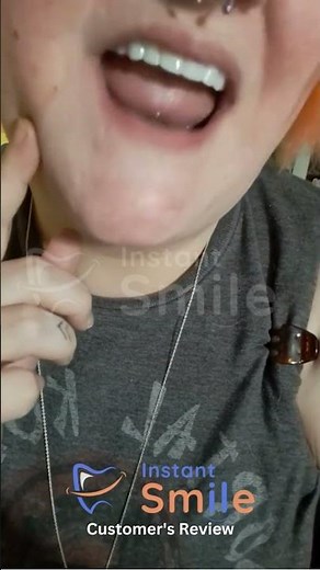 Kayla Patterson ❤️ Instant Smile Teeth Veneers 😁 Customer's Review 2026