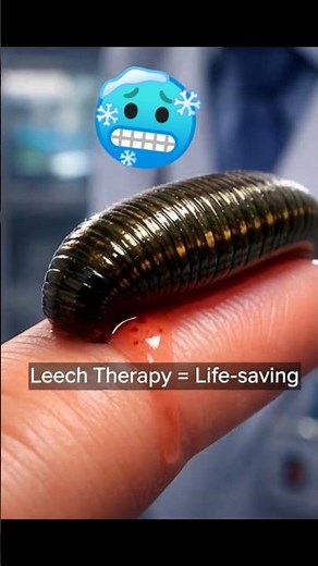 Life-Saving Leeches | Medical Science Secrets Revealed #facts