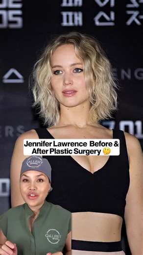 Jennifer Lawrence plastic surgery. #jenniferlawrence #plasticsurgery #plasticsurgeon #celebrity | ladyplasticsurgeon