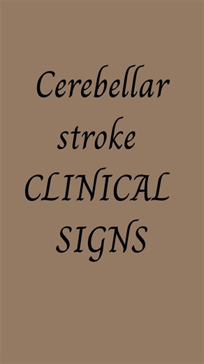Saghar taban on Instagram: "Now You tell me right or left cerebellar stroke? 🧠 #stroke #Neuro #rehabilotation #physiotherapy #Neurology"