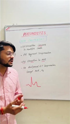 Pericarditis ECG 🔥 ST Elevation but NOT MI?! 😳 #cardiology #biology #medical #chemistry #science