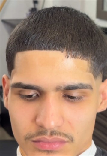 Allentown's Premier Barber Service: Hairline Surgery Explained