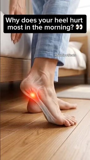 Why Your Heel Hurts Most in the Morning | Plantar Fasciitis Explained 👣
