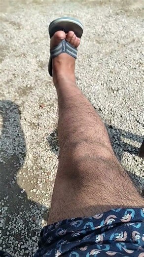 Daily exercise after surgery and best result #youtube #femurfracture #exerciseroutine