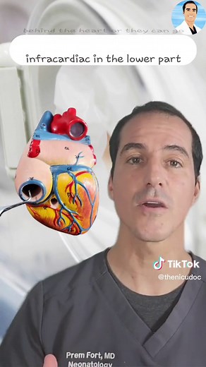 Understanding TAPVR Heart Disease: The 5 Finger Trick Explained!