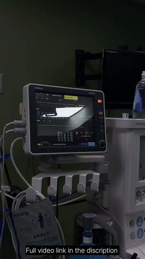 General Anesthesia | Anesthesia Machine |