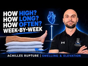 Achilles Rupture Swelling: Optimal Elevation Protocol