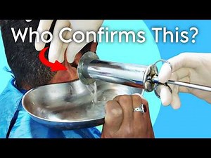 MOST SATISFYING EarWax Cleaning | #earwaxremoval #earwaxremoving #earwax