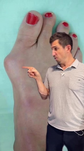 31K views · 255 reactions | Are your shoes crushing you toes and...