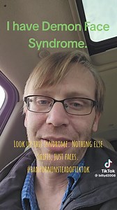 54K views · 975 reactions | I have Demon Face Syndrome. - Will I am...