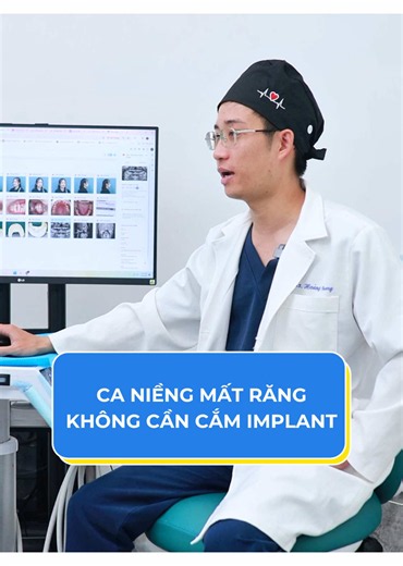 Mất răng không cần cắm implant khi niềng #implant #matrang #xuhuongtiktok