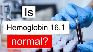Is Hemoglobin 16.1 normal, high or low? What does Hemoglobin level 16.1 mean?
