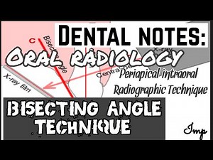 BISECTING LINE ANGLE RADIOGRAPHIC TECHNIQUE II LE MASTER TECHNIQUE?? II INTRAORAL RAGIOGRAPHY