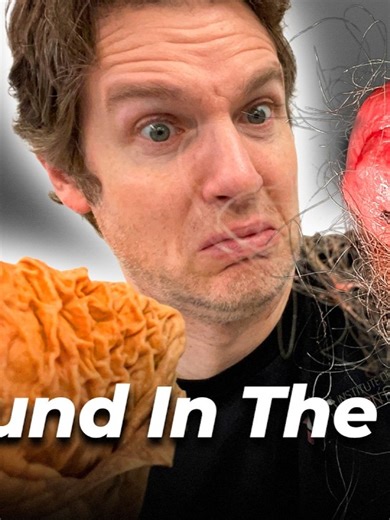 5 Shocking Things People Swallow: Anatomy Insights