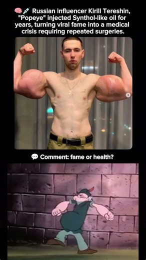 🧠🦾 The Dangerous Truth Behind Popeye’s Inflated Muscles #shorts #popeye #influencer