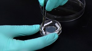 Kinetic Visualization of Single-Cell Interspecies Bacterial Interactions