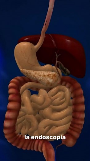 Endoscopia Digestiva Alta: Procedimiento y Beneficios