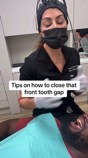 Front tooth gap ? How to close it #fy #fyp #dental #houstondentist #teethtok #teeth #compositebonding #gap #space #invisalign #frontteeth #howto (713)621-5141