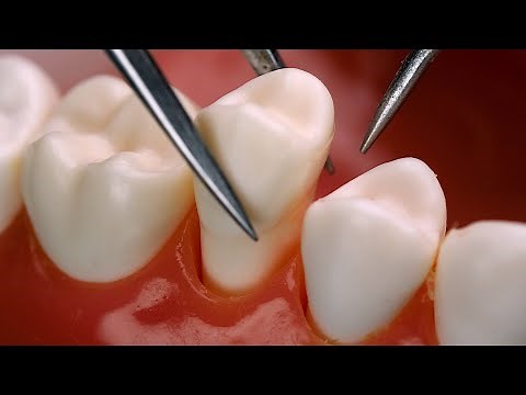 [ASMR] An amateur dentist implants 🦷 [Roleplay, tartar removal]