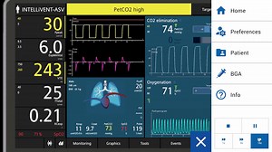 2.3K views · 175 reactions | #VenTrainerUpdate! Are you ready to...