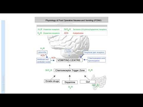 Post Operative Nausea and Vomiting (PONV) | Anaesthesia