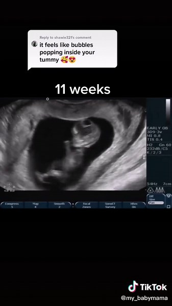 Understanding Baby Movements During Pregnancy: What Do Babies Feel Inside the Tummy?