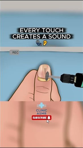 Medical ASMR Animation #asmr #asmrsounds #asmrvideo #medical #clinic #animation #shorts #shortvideo