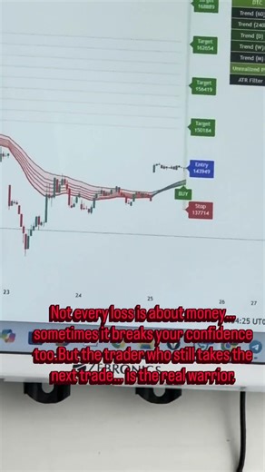 DTC Indicator LIVE Trading 🔴 | Real Office Setup 📊 | High Accuracy Entries 💥 #shots