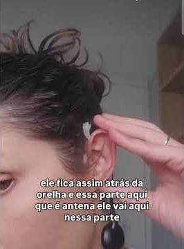 O que é Implante Coclear? A tecnologia que devolve a audição