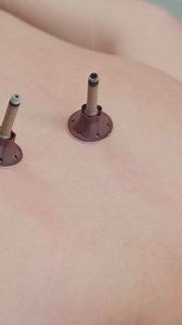 373K views · 787 reactions | ASMR stretching and chiropractic adjustments for Lisa #chiropracticadjustment #chiropractic #chiropractor #adjustment #asmr #fypシ゚viral #reels #viralreels #reelsfb #tranding | lichi | Facebook