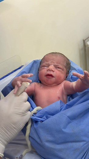 Understanding the Moro Reflex in Infants